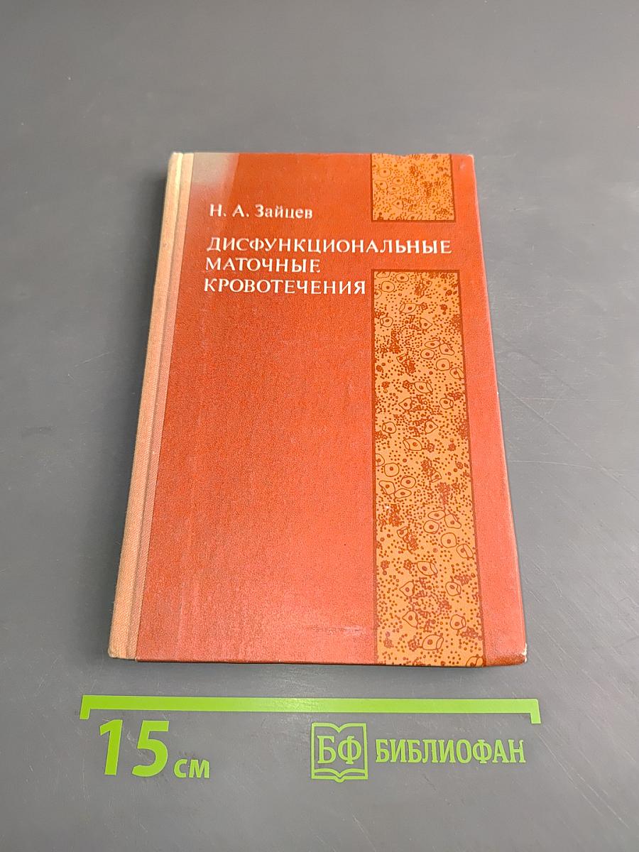 Дисфункциональные маточные кровотечения
