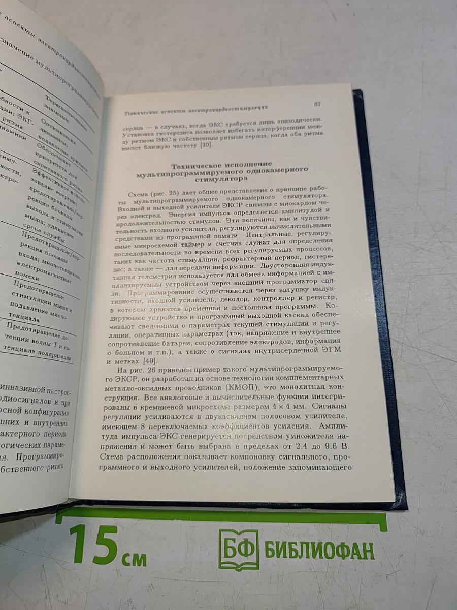 Электрокардиотерапия. Технические аспекты электрокардиостимуляции