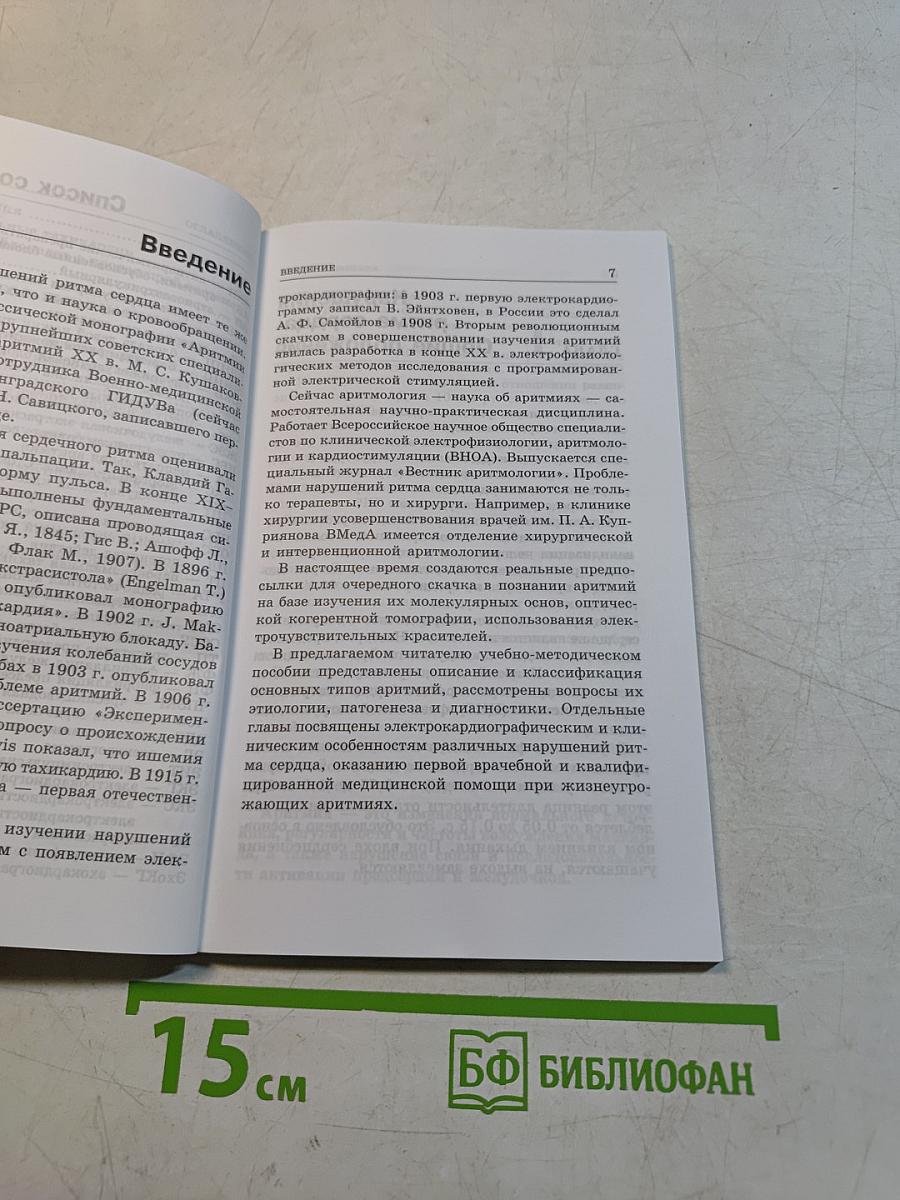 Нарушения ритма сердца