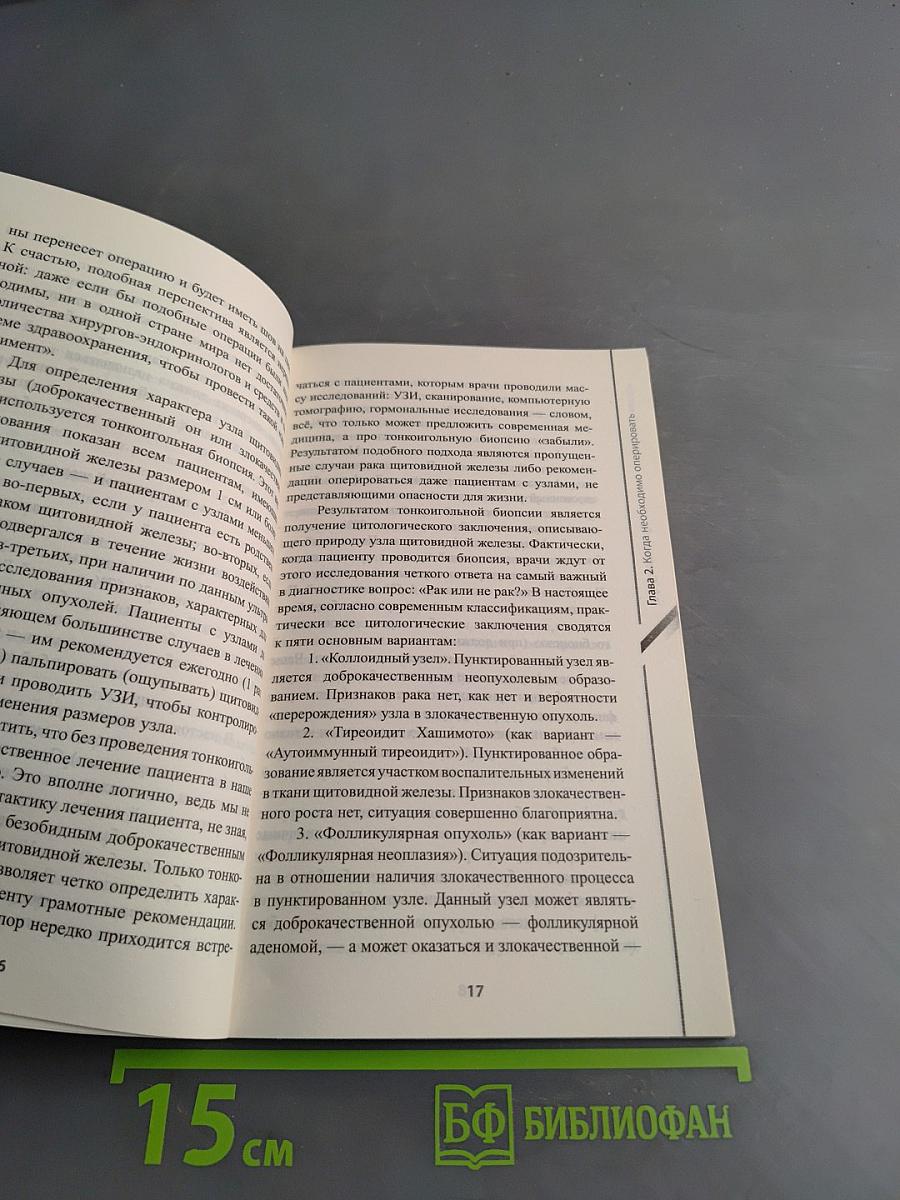Операции на щитовидной железе. Пособие для пациентов