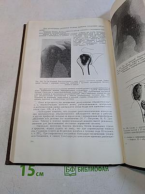 Рентгенодиагностика профессиональных болезней