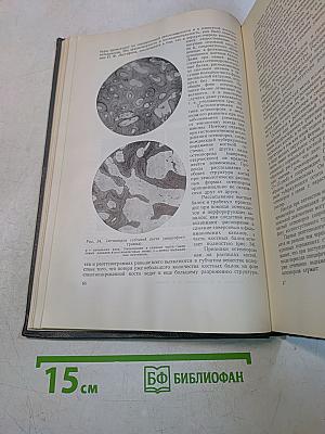 Рентгенодиагностика костно-суставного туберкулеза
