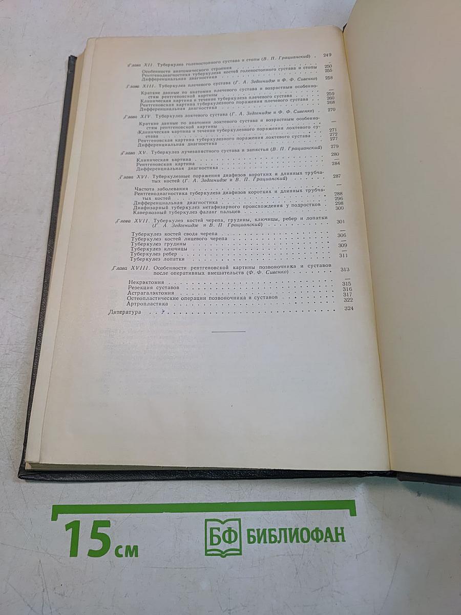 Рентгенодиагностика костно-суставного туберкулеза