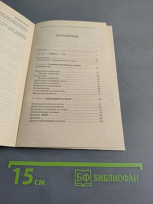 Ваши глаза. Вопросы и ответы