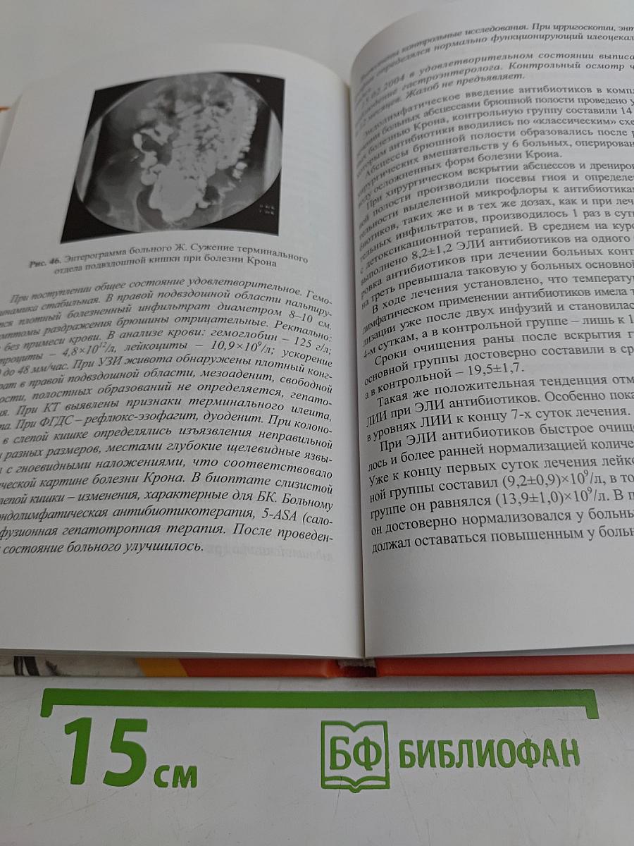 Эндолимфатическая лекарственная терапия острых воспалительных заболеваний в неотложной абдоминальной хирургии