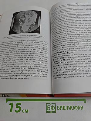 Эндолимфатическая лекарственная терапия острых воспалительных заболеваний в неотложной абдоминальной хирургии