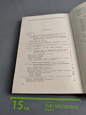 Острый аппендицит
