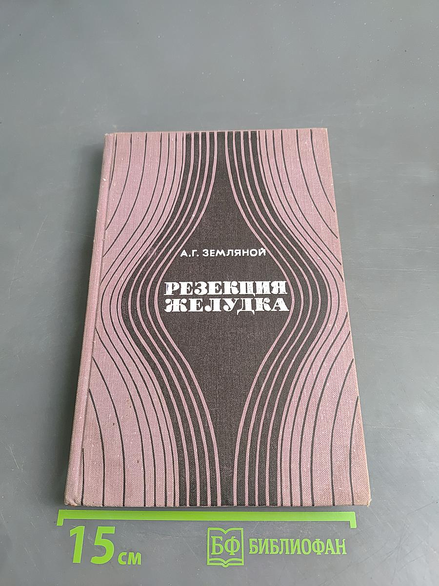 Резекция желудка