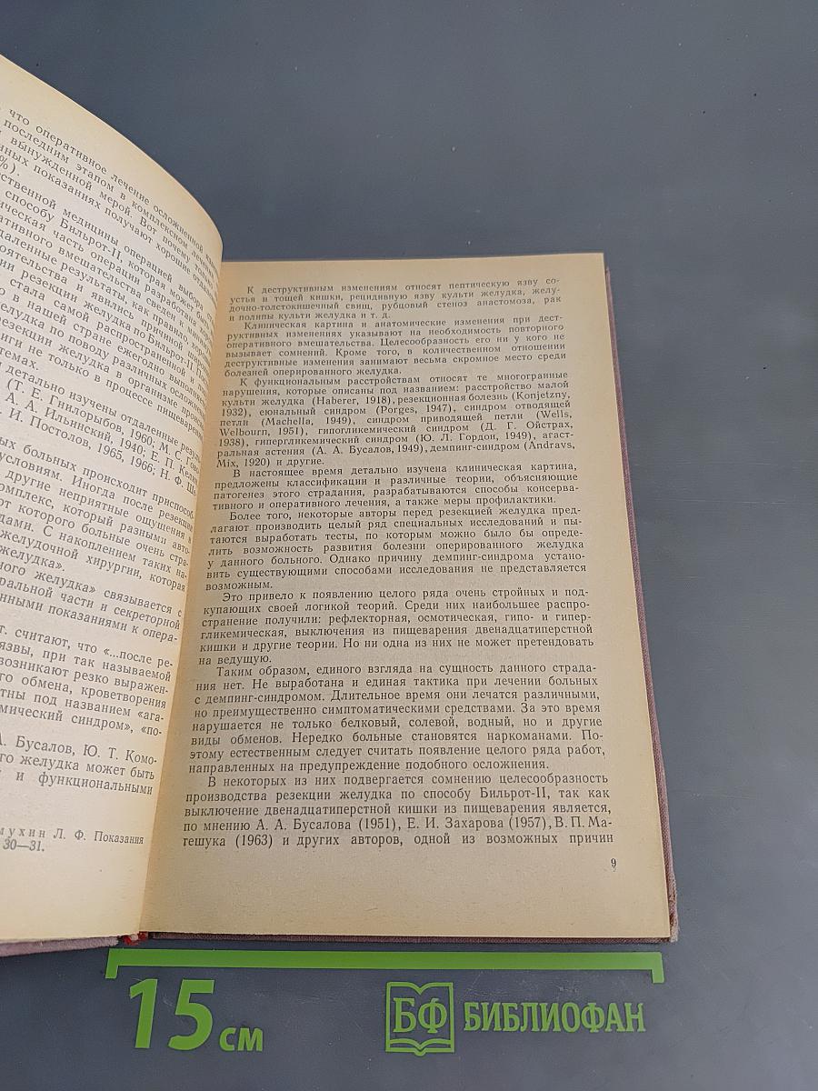 Резекция желудка