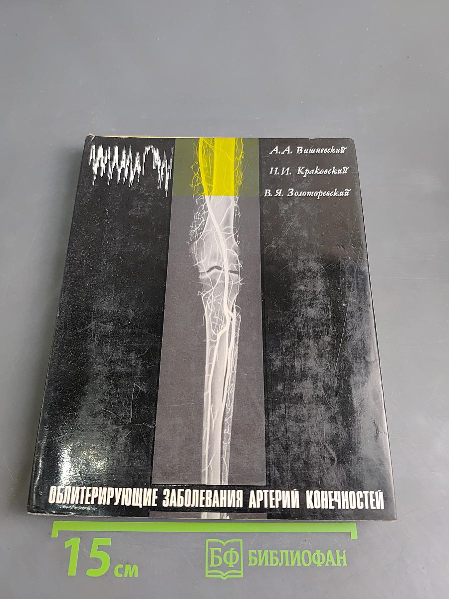 Облитерирующие заболевания артерий конечностей