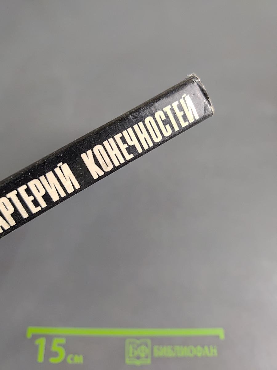 Облитерирующие заболевания артерий конечностей