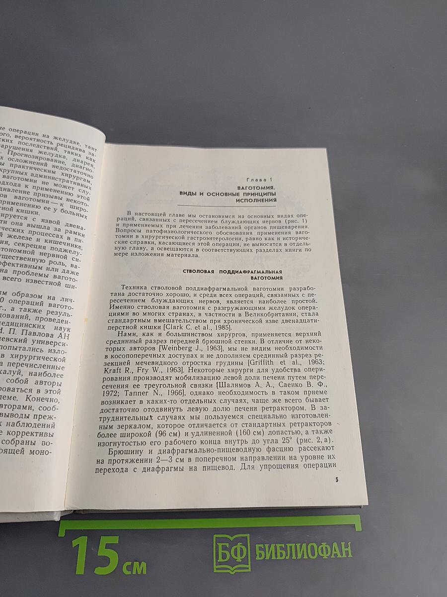 Ваготомия в хирургической гастроэнтерологии