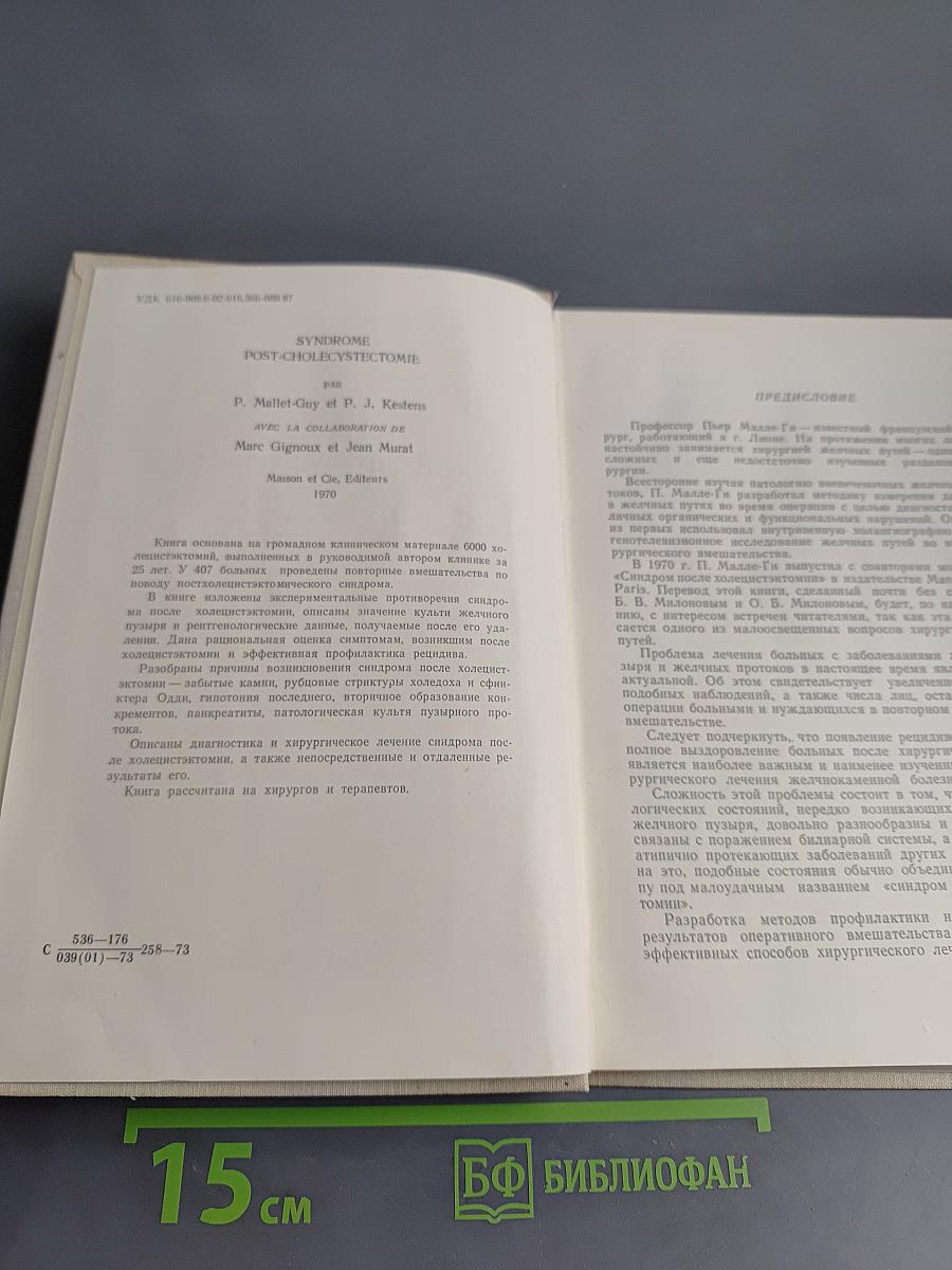 Синдром после холецистэктомии