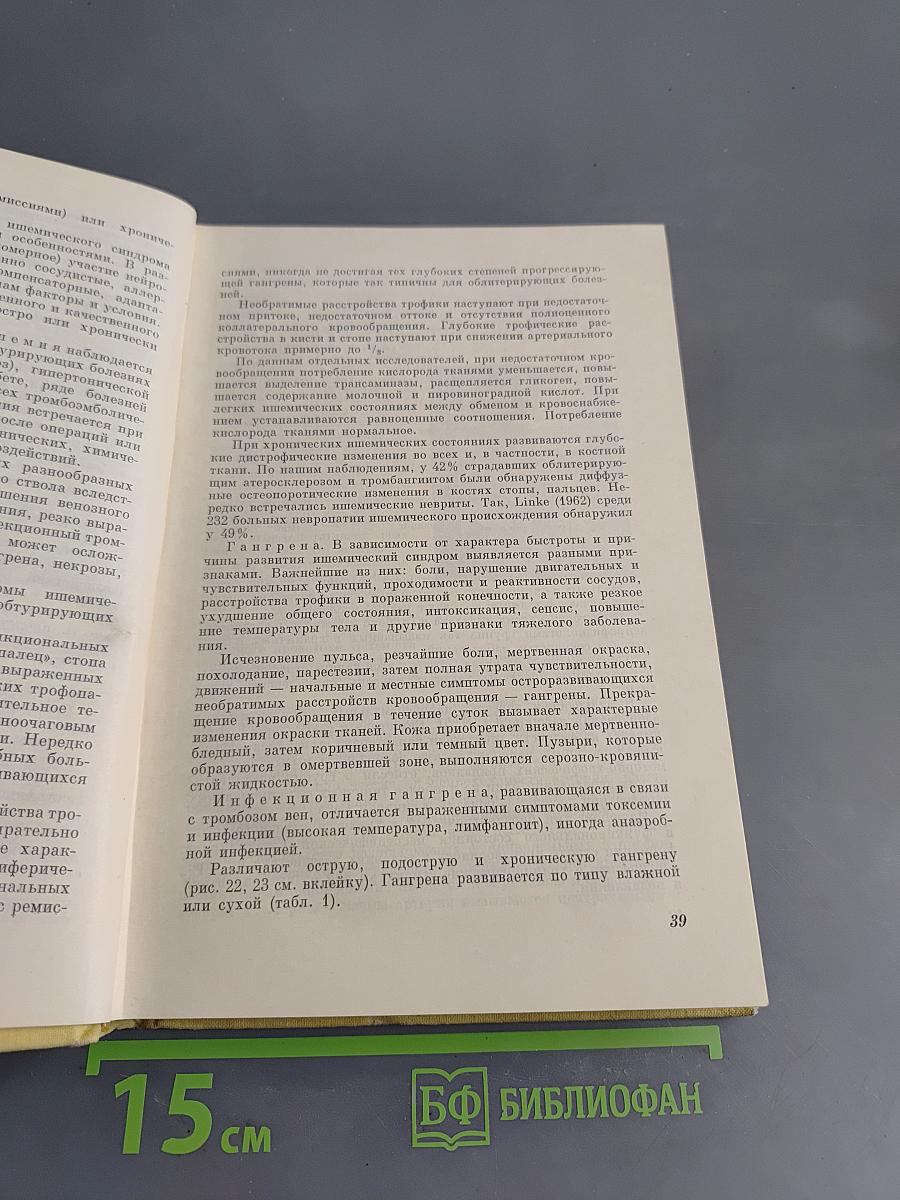 Заболевания периферических сосудов