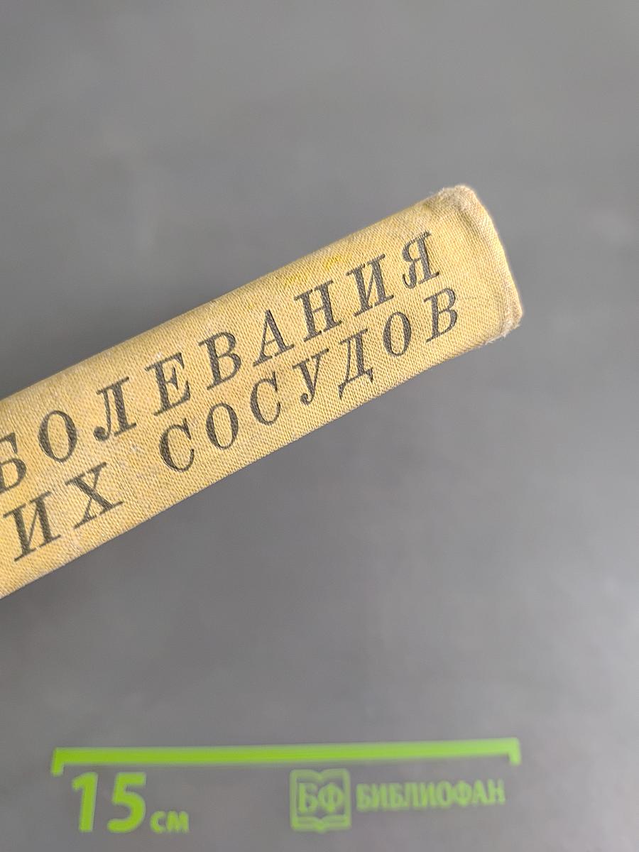 Заболевания периферических сосудов