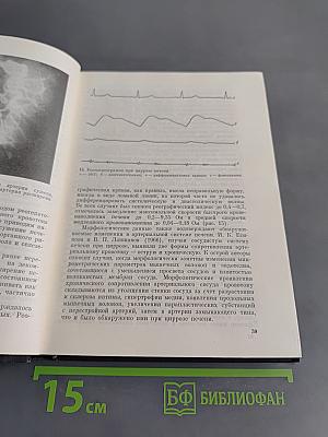 Хирургия портальной гипертензии