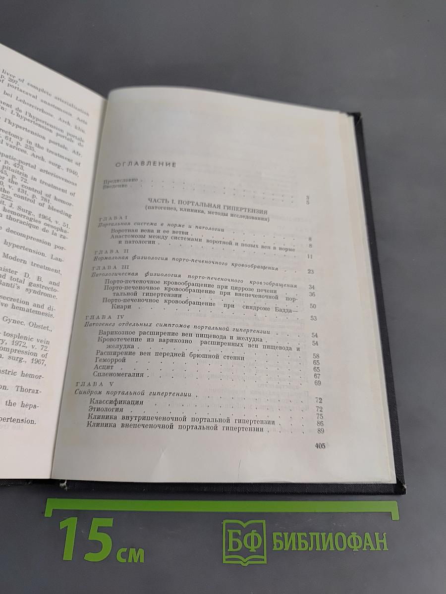 Хирургия портальной гипертензии
