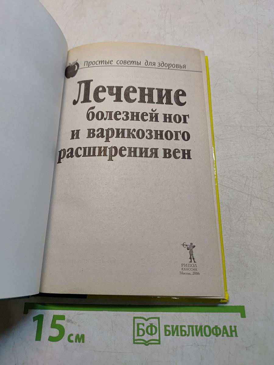 Лечение болезней ног и варикозного расширения вен