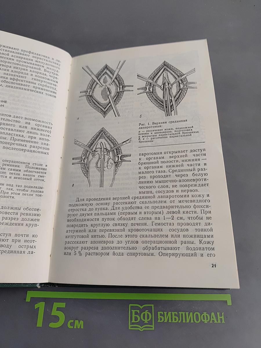Неотложные оперативные вмешательства в абдоминальной хирургии