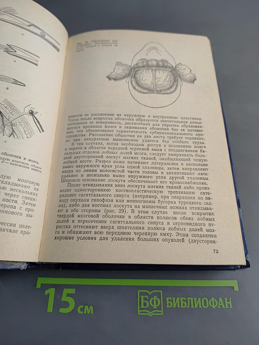 Нейрохирургия