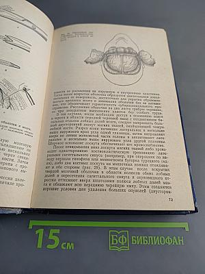Нейрохирургия