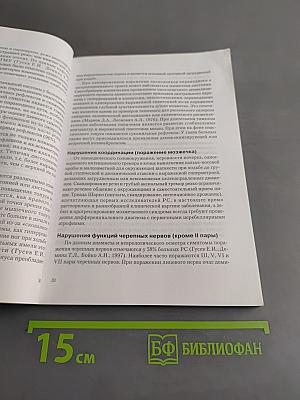 Рассеянный склероз
