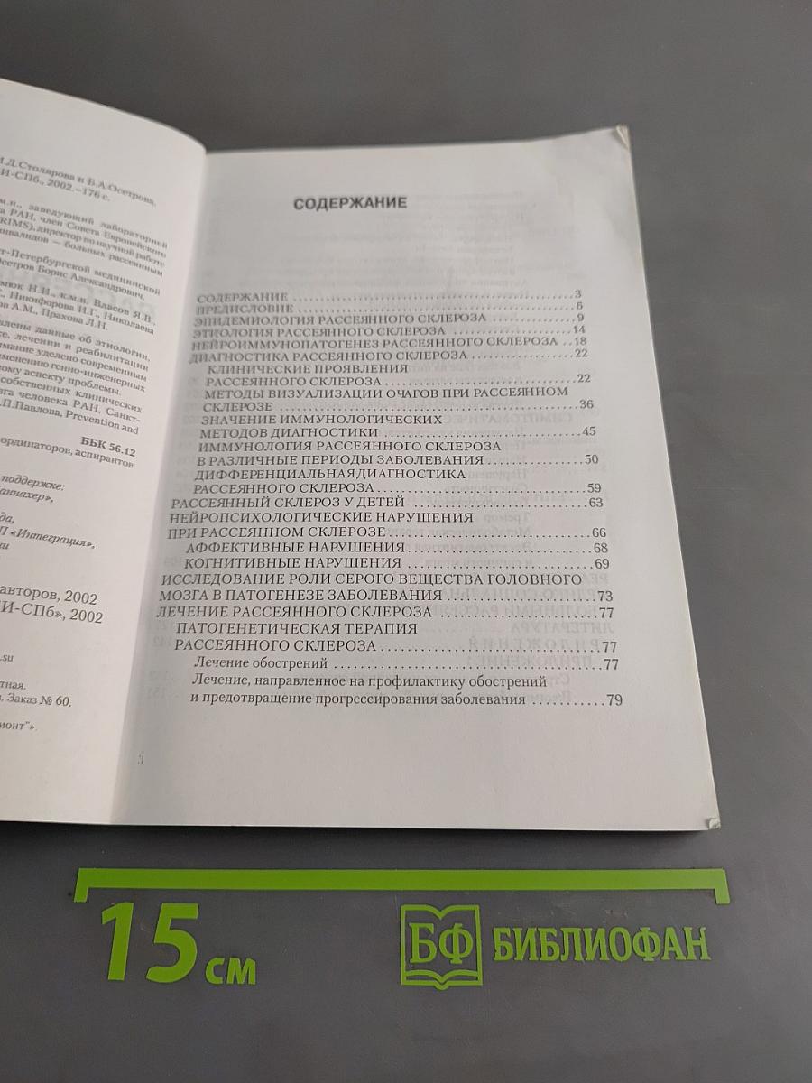 Рассеянный склероз