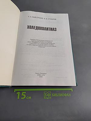Холедохолитиаз