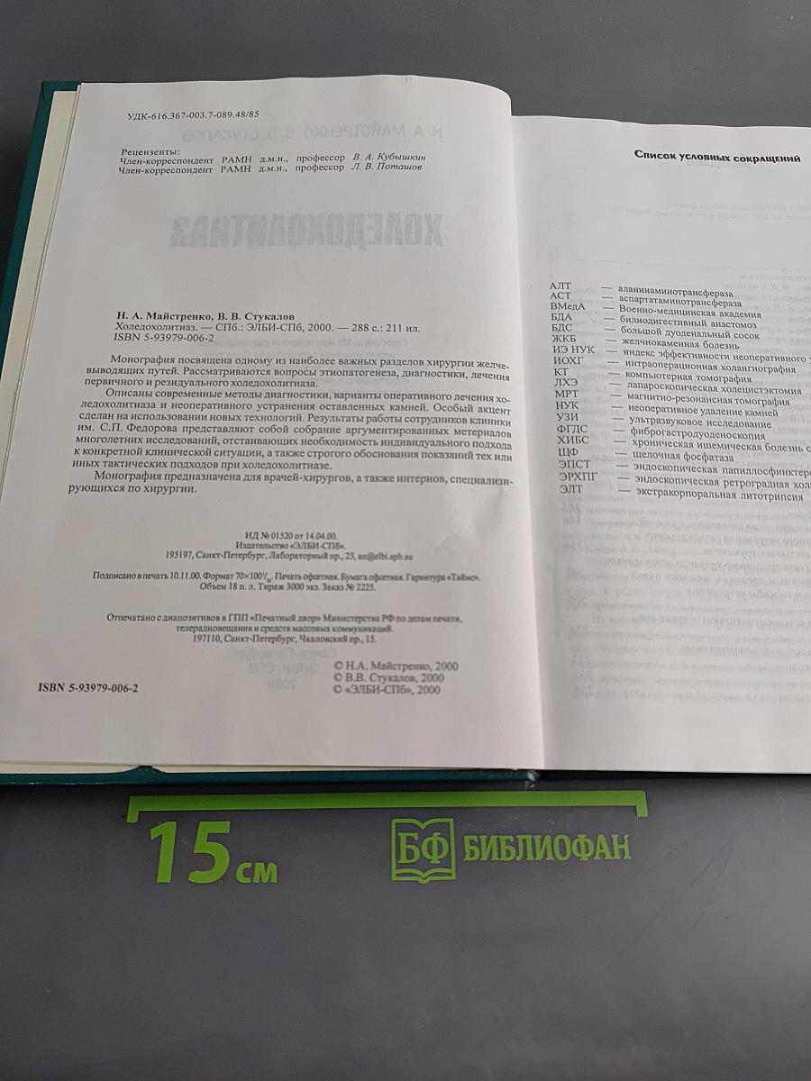 Холедохолитиаз