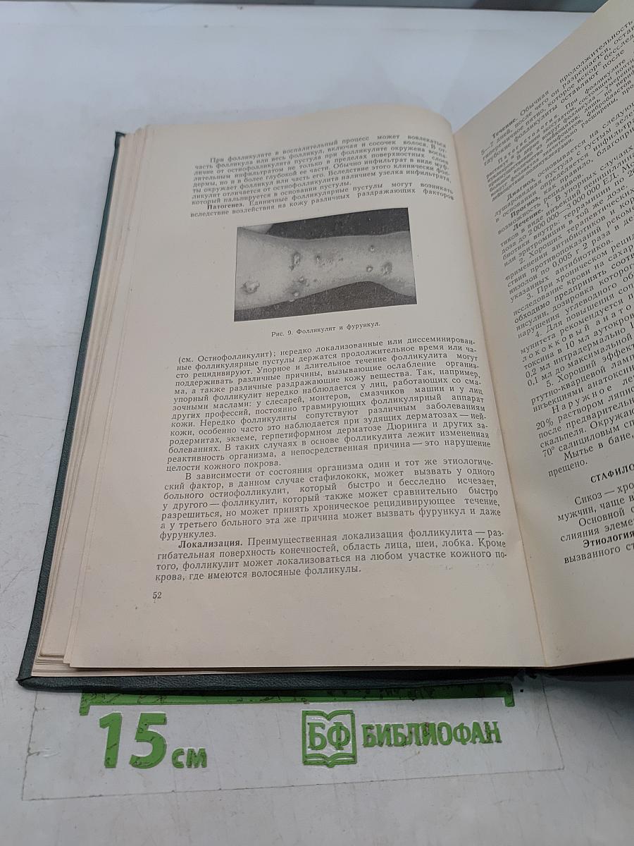 Кожные и венерические болезни