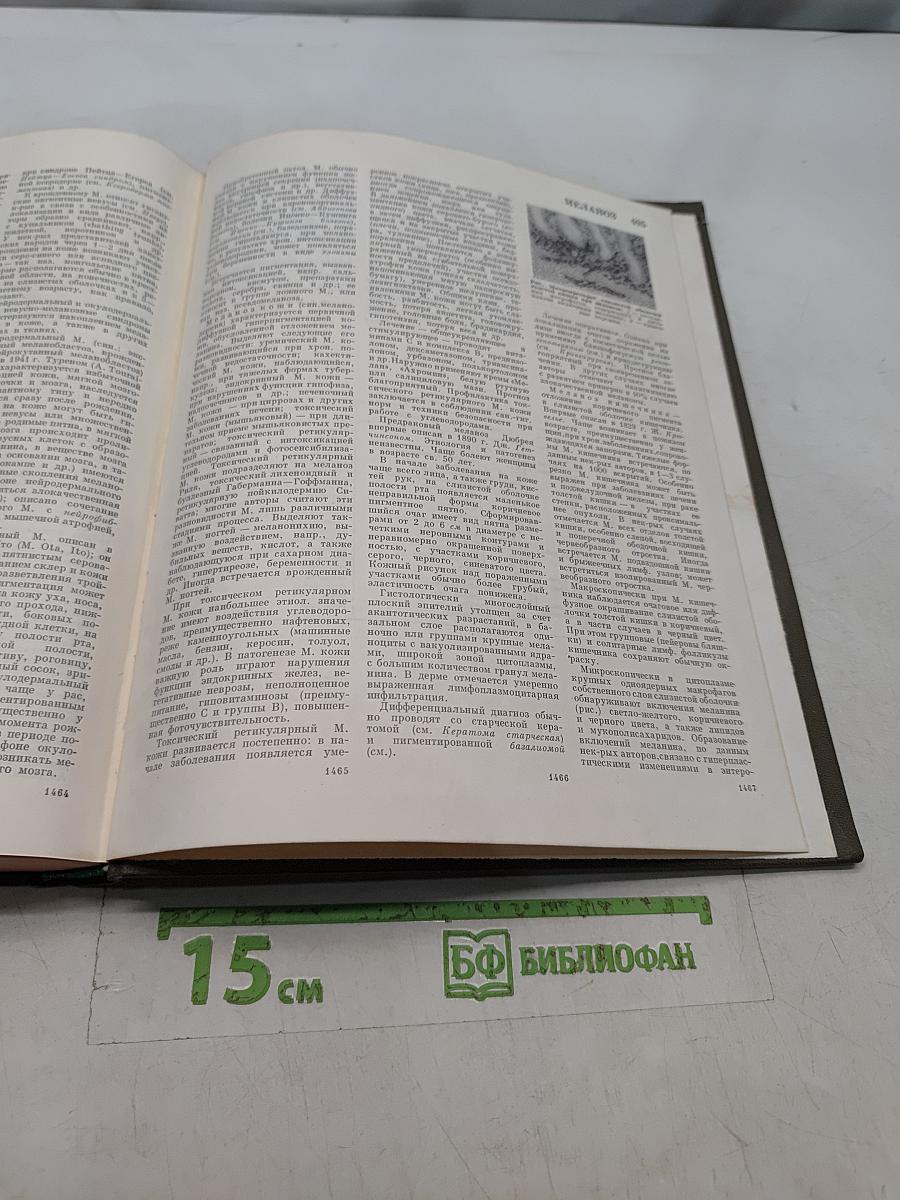 Большая медицинская энциклопедия. Том 14. Медицина – Меланоз
