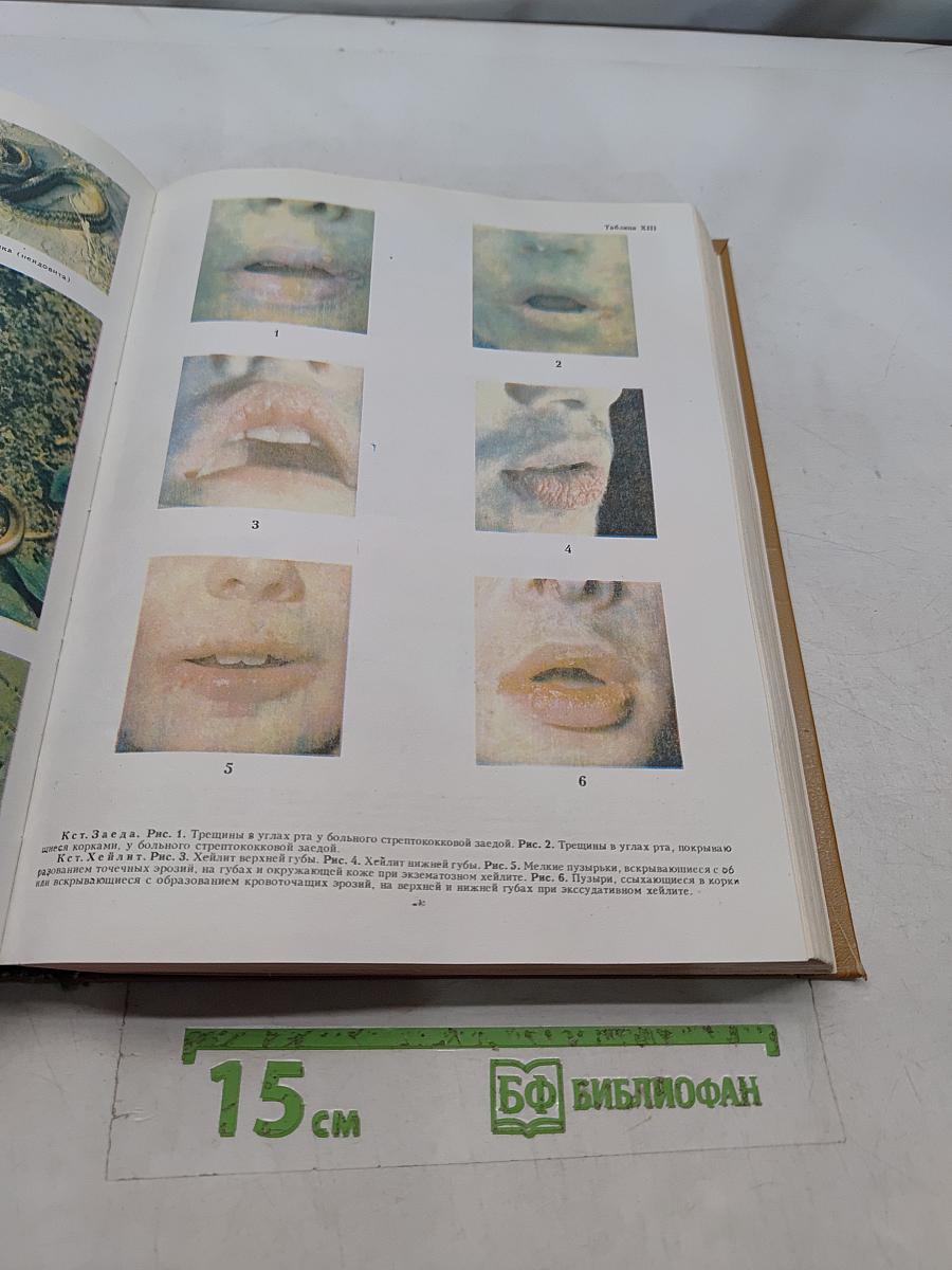 Популярная медицинская энциклопедия