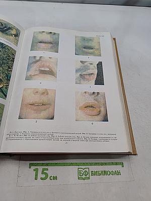 Популярная медицинская энциклопедия