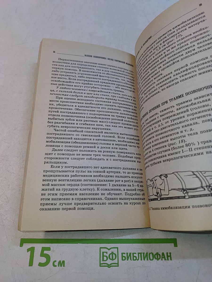 Болезни позвоночника: взгляд современной медицины