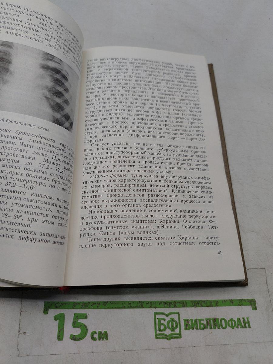 Руководство по фтизиатрии