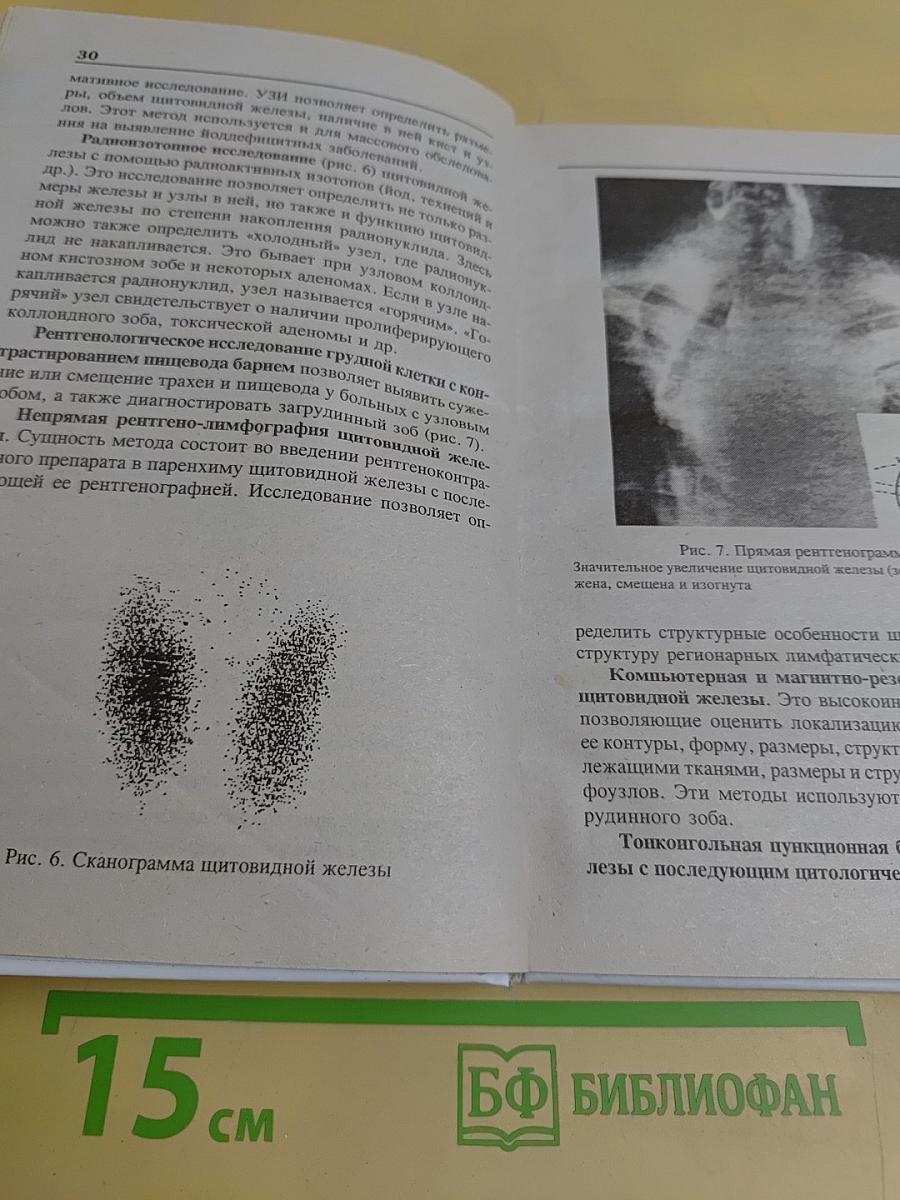 Щитовидная железа: диагностика, лечение, профилактика заболеваний