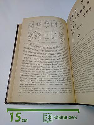 Ошибки развития