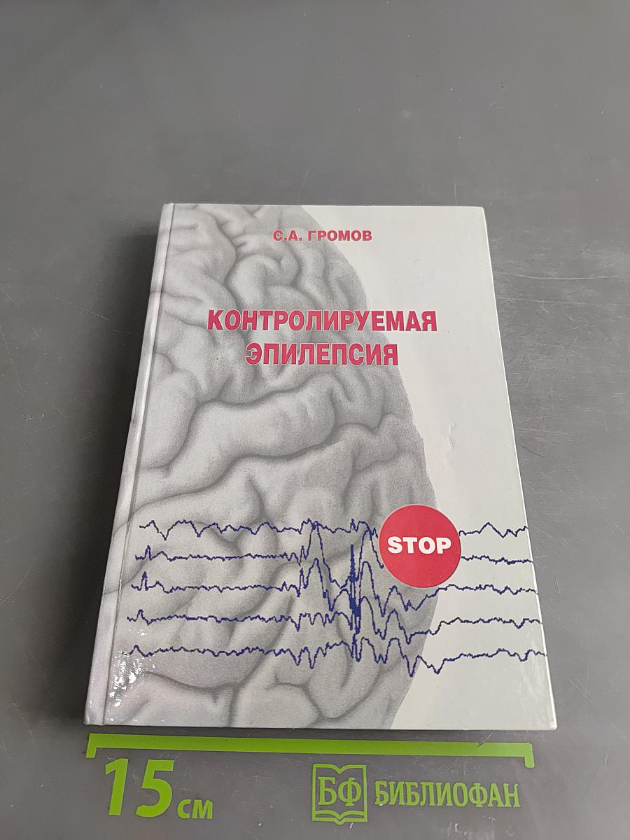 Контролируемая эпилепсия. Клиника, диагностика, лечение