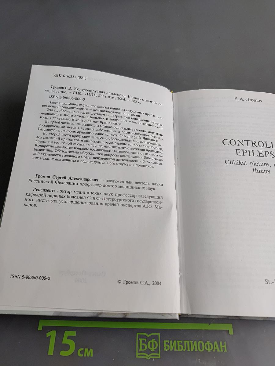 Контролируемая эпилепсия. Клиника, диагностика, лечение