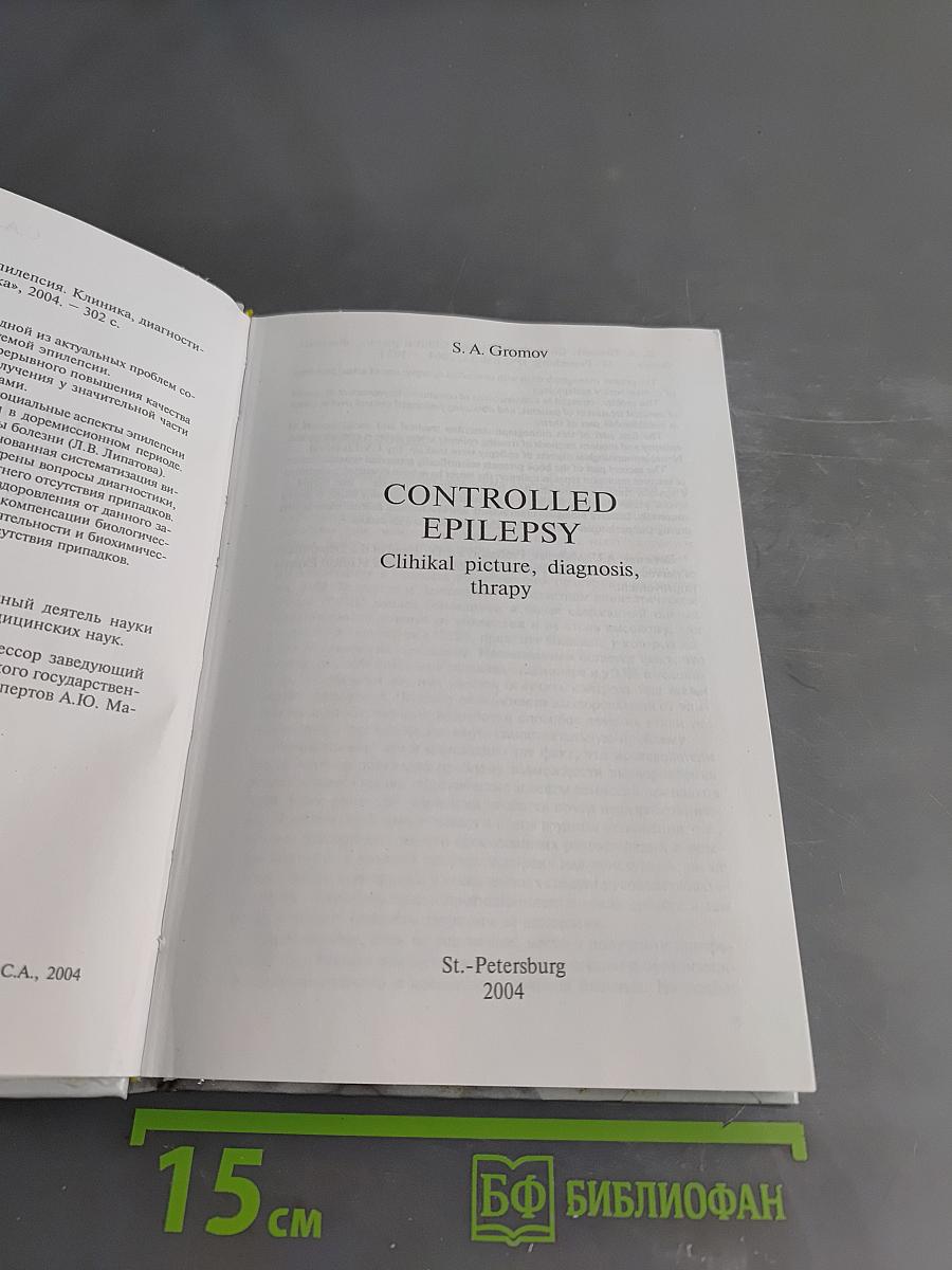 Контролируемая эпилепсия. Клиника, диагностика, лечение