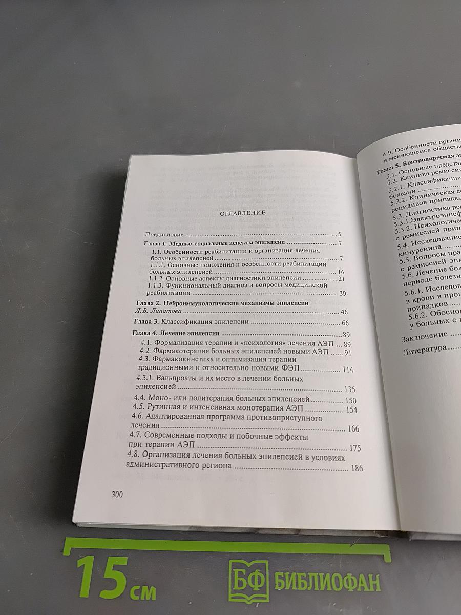 Контролируемая эпилепсия. Клиника, диагностика, лечение