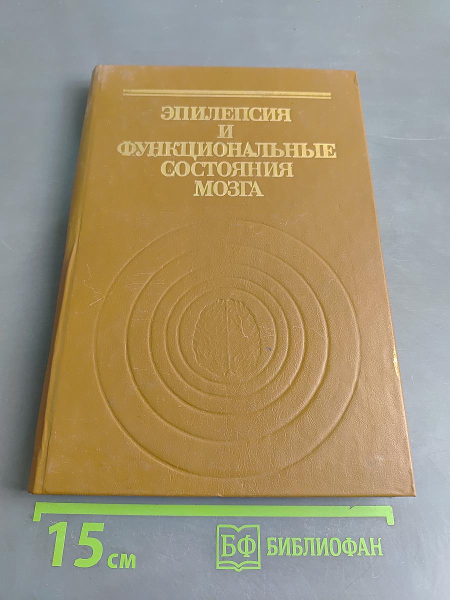 Эпилепсия и функциональные состояния мозга