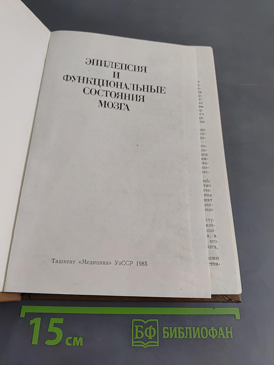 Эпилепсия и функциональные состояния мозга