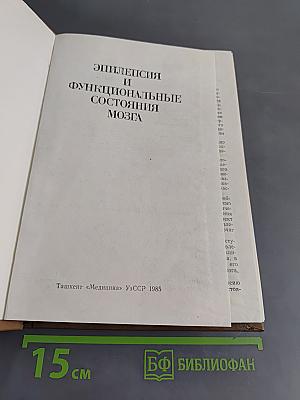 Эпилепсия и функциональные состояния мозга