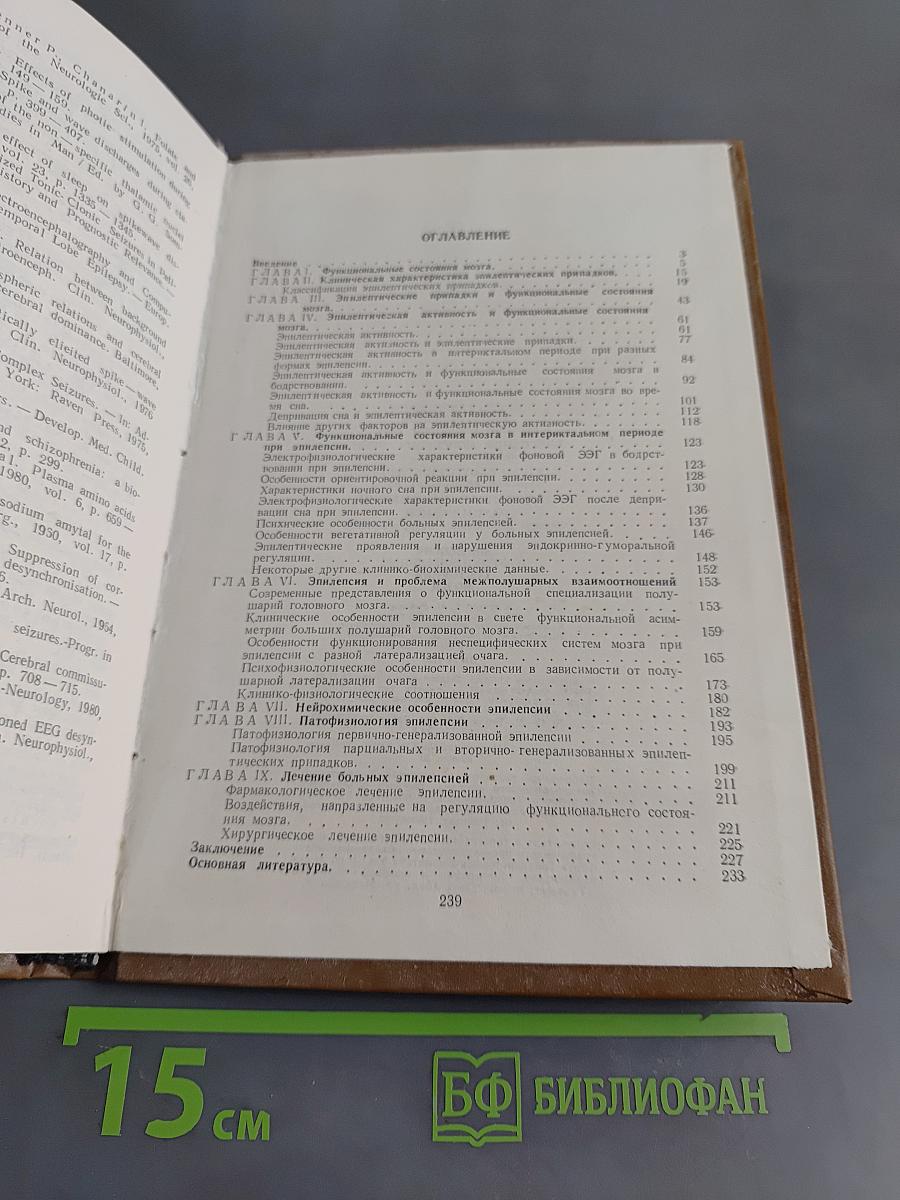 Эпилепсия и функциональные состояния мозга