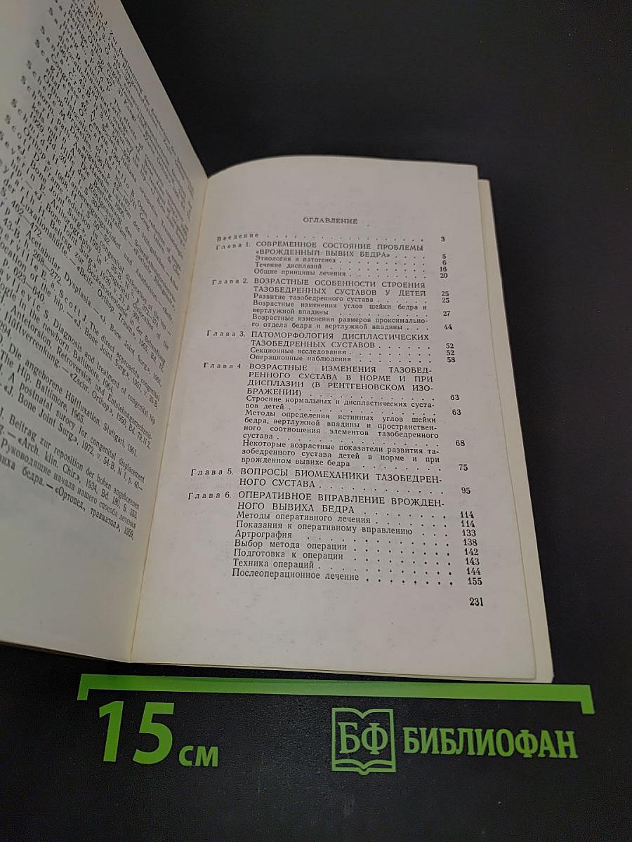 Оперативное лечение врожденного вывиха бедра у детей