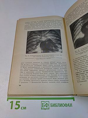 Диагностика врожденных пороков сердца и результаты хирургического лечения