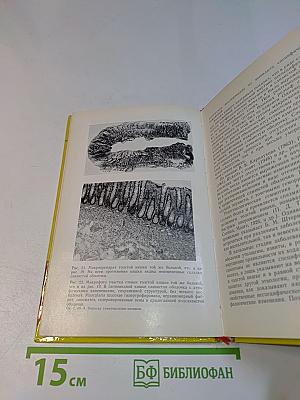 Клинико-рентгенологическая диагностика неспецифического язвенного колита