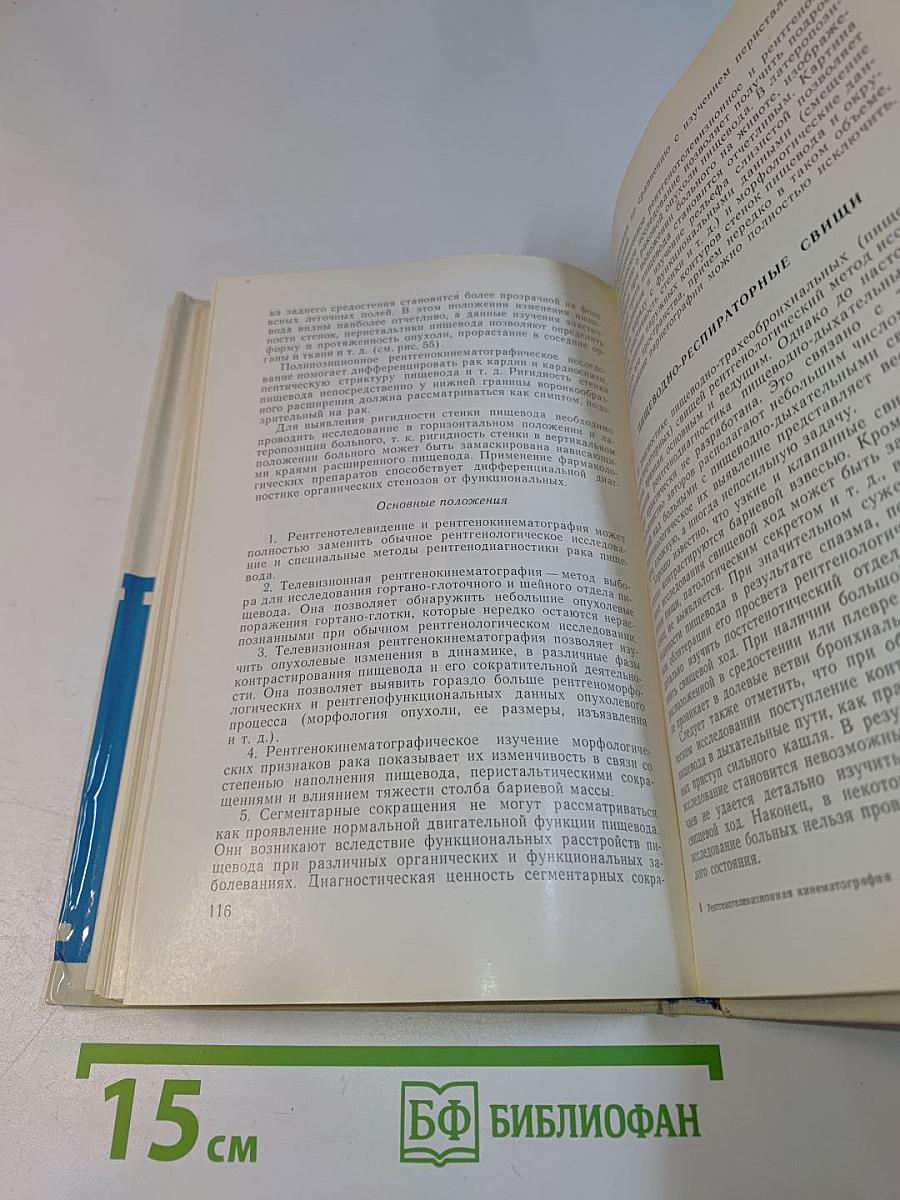 Рентгенотелевизионная кинематография пищевода