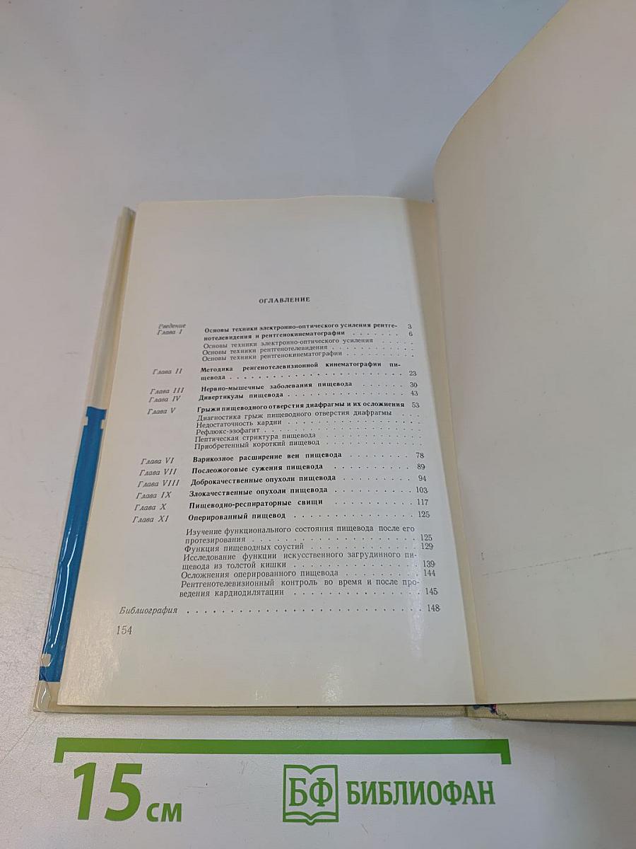 Рентгенотелевизионная кинематография пищевода
